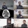 박규리 "30대 뇌출혈 진단..수박이 쩍 갈라지는 정도 두통" [생로병사의 비밀]