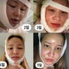 적나라한 후기, 퉁퉁 부은 얼굴..셀럽들의 과감한 성형 고백 [★FOCUS]