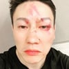"추성훈에 미안" H-유진, 충격적인 눈 피멍+터진 입술..왜?