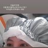고은아, 코 재수술 후 난리난 두피 "요즘 왜 이러는 거지"
