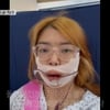 10기 영자, 양악수술로 환골탈태? "죽음·장애 각오..심적으로 힘들었다"[나솔사계][★밤TV]