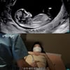 '임신' 황보라, 기형아 검사 중 子 코뼈에 감탄 "난 낮은데.."[스타이슈]