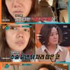 고은아 "모발 3800모 이식→미르, '인생 바뀐다'고" [강심장VS][★밤TView]