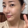 '조혜련 올케' 박혜민, 코 수술 이후 모습 "흉터 왜 없어?" 말끔하네