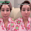 김송, 광대 수술 35일 차 공개 "마음에 들어..오지랖 글은 차단"