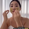 '사업가♥' 최희, 레이저 시술+잦은 음주로 피부 트러블 "뾰루지 올라와"