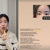 '나는 솔로' 10기 영숙, 쌍꺼풀 시술 후 부은 눈.."DM 문의 폭주"