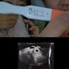 15기 옥순♥광수, 임신 발표 "벌써 5주차..신기하고 얼떨떨"