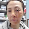 전혜진, 끔찍한 사고로 피 범벅 "얼굴 콘크리트에 떨어져..밤새 진물 닦아"