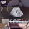 박수홍♥김다예, 16주 된 2세 이목구비에 뿌듯 "진짜 예뻐" [행복해다홍] [종합]