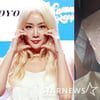 씨스타 소유, 찢어진 렌즈에 각막 손상 "눈 안 보여 너무 놀라"
