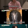 '43세' 이동건 "흑채 10년 넘게 뿌려"..탈모→두피문신 결정[미우새]