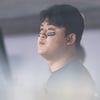 NC 천만다행, '리틀 페디' 팔꿈치 이상 없다 "수술 NO, 10일 후 복귀 가능" [창원 현장]