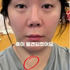 허안나, 갑상선암 의심→절제 수술 "기력 훅 떨어져..고혈압도 2단계"