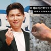 '홍현희♥' 제이쓴, 돌연 해파리에 쏘였다..손목 발진 '깜짝'