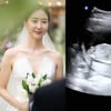'요정컴미' 전성초, 유산 1년만 임신 "아이 잃고 무기력증..힘들었다" [전문]