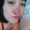'코 재수술 중형차값' 고은아, 낙상사고로 코 심각한 부상.."나 얼굴로 먹고사는 앤데"[스타이슈]