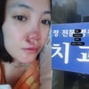 '코 수술 9시간' 고은아, 빙판길 사고→치아까지 갈렸나.."내 앞니 우짜노"
