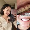 "새 인생 시작" 고은아, 심각한 안면 부상 치료 후..밝은 미소