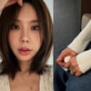 김준희 "트라우마로 고민 끝 3시간 대수술, 장하다 내 딸"