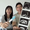 '유산 후 임신' 지소연♥송재희, 미담까지 등장 "이런 연예인 가족 처음"