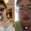 41kg 최준희, 루푸스병 모습 보니.."하루 5끼 기본" 경악[스타이슈]