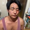 전호준, 피범벅 얼굴+前여친 몸싸움 녹취록 공개.."성병 옮기고 폭행" 주장 반박