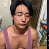 '前여친 폭행+성병 부인' 전호준, 피투성이 얼굴→녹취록 공개.."때리지 마" 비명 [종합]