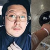 김대호, 말라리아 감염 "이유 몰라..혈소판·신장 문제 생겨"