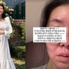 "약 끊었다" 김지혜, 임신 후 낙상 이어 항생제 부작용 호소