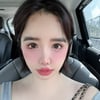 박봄, 눈 흰자에 큰 빨간점 '건강 염려'..美 2NE1 공연 불참 이유 이것?[스타이슈]