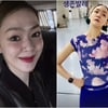 '뇌신경마비 투병' 김윤아, 살기 위해 운동하는 일상.."생존 발레"