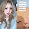 '96kg→41kg' 최준희, 튼살 고민 "상처 하나하나 지움" 심각하네