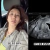 '이특 누나' 박인영 유산 고백 "울컥하지만 힘내려고요" 먹먹[스타이슈]