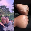 "당했다" 최여진, ♥남편과 나란히 말벌에 쏘였다..퉁퉁 부은 손