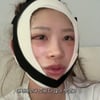 '광대수술' 최준희 충격 비주얼 "앞이 안보인다..3개월 지나야 안정"