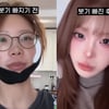 '광대성형' 최준희 전후 모습 보니.."이번엔 좀 무서웠다"[스타이슈]