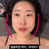 '눈·코·가슴 성형' 이세영, 또 달라진 얼굴 "대박"