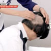 '팽현숙♥' 최양락, 휑한 뒤통수..충격적인 모발이식 상태 "상처 多"[1호가][별별TV]