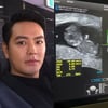 이지혜와 동업 후 경사..샵 장석현 "손발 나왔다" 아내 임신 9주 차