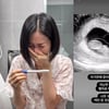 초아, 임신 10주 '쌍둥이 임밍아웃'.."토덧으로 3kg 빠져"