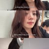 김지영, 젊은 녹내장 환자였다 "6개월마다 검진..병원 갈 때마다 무서워"