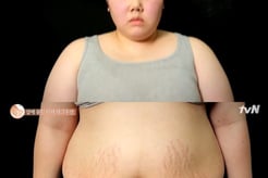 '렛미인'서 34kg 뺐던 '미녀 개그우먼' 근황? "체중 127kg, '먹토'하며 '먹방'" [줄여주는 비서들2]