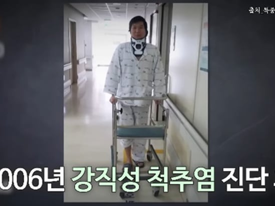 자취 감췄던 김시덕 "강직성 척추염 앓아, 현재는 완전 멀쩡..주사 치료도 NO"