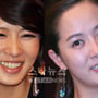 1번째 이미지