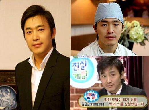↑천지훈 성형외과 전문의.