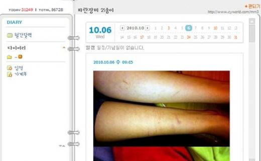 <사진=김미리내 다리 폭행사진, 김미리내 미니홈피 출처>