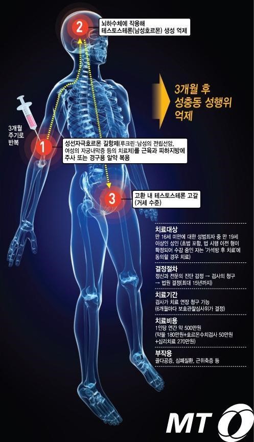 ▲ 화학적 거세 어떻게 진행되나 ⓒ머니투데이=강기영 디자이너