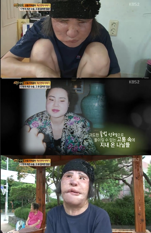 /사진=KBS 2TV '여유만만' 방송캡쳐