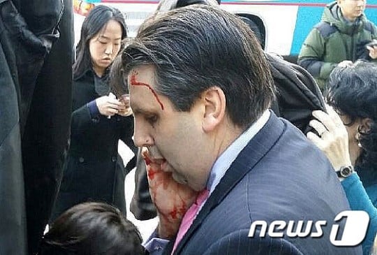괴한에 피습을 받아 병원으로 이동하는 마크 리퍼트 주한 미국대사. /사진=뉴스1